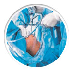 Era of quick knee replacement